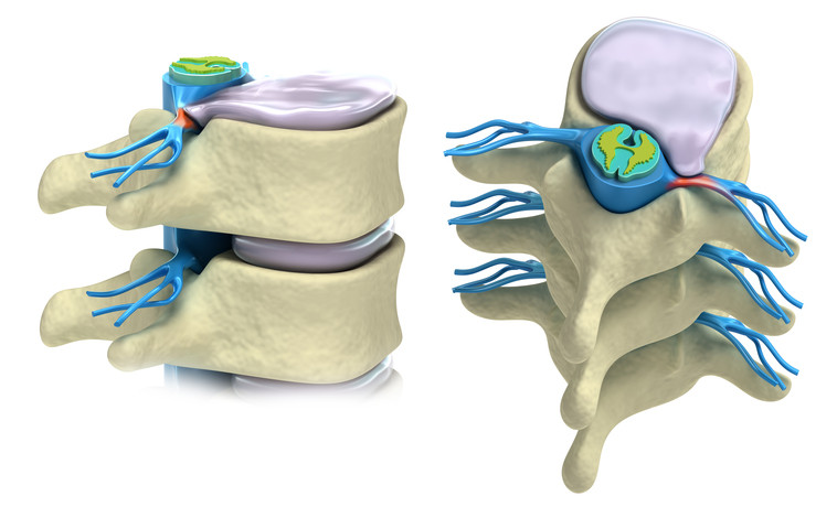 Administration of Osteopathy in Neck Pain Treatment