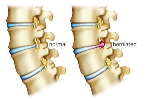 Clinique Tagmed: A Qualified Osteopathy Center for Body Pain Management